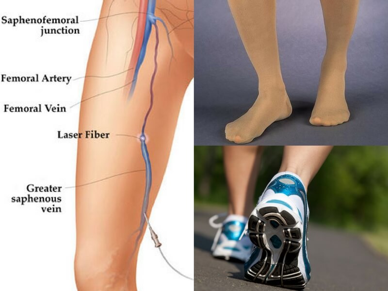 Useful Tips For Healthy And Beautiful Legs