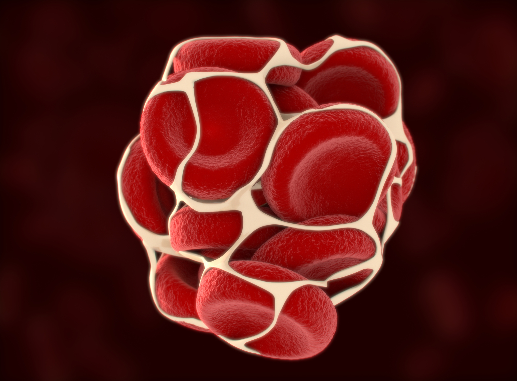 Blood Clot Types