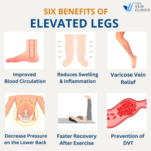 Health Benefits Of Elevating Legs Improve Circulation Reduce Swelling