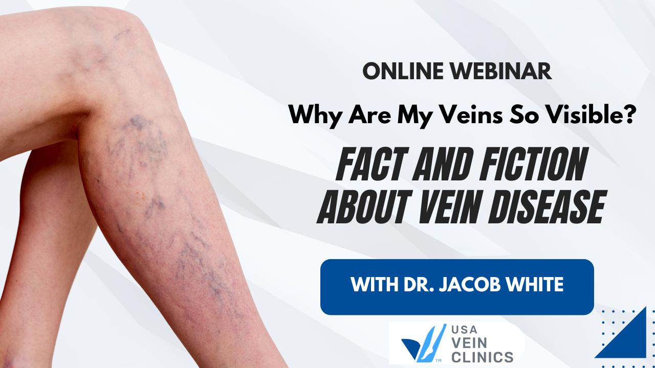 Free veins live event online - ask the expert – The Whiteley Clinic